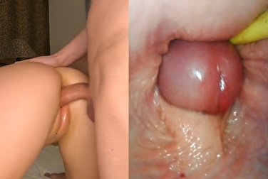 Haben Sie schon einmal einen Creampie von innen gesehen? Wenn nicht, schauen Sie zu 👀 (Kamera in der Muschi)